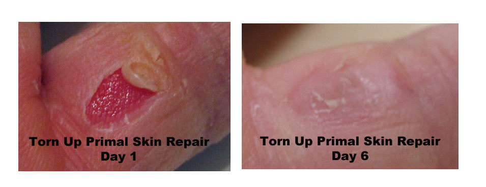 Torn Up Skin Repair by Primal Life Organic II LLC