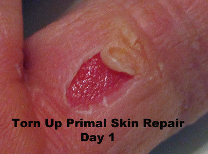 Torn Up Skin Repair by Primal Life Organic II LLC