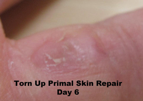 Torn Up Skin Repair by Primal Life Organic II LLC