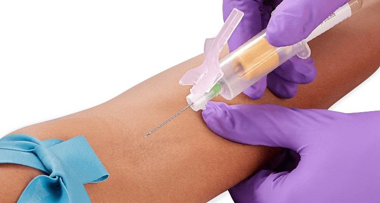 BD Vacutainer Eclipse Blood Collection Needles with Holder and Luer Adapter, 21G x 1.25", 100/CS