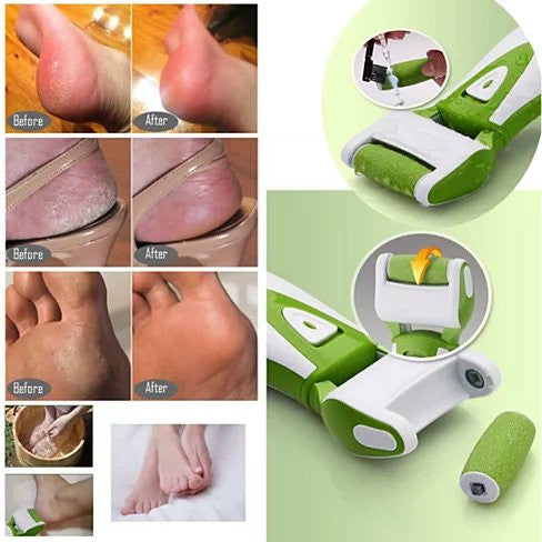 ROLL ON SOLE FOOT SPA - BRING SPRING IN YOUR STEP Vista Shops